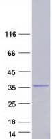 Human SDCBP / Syntenin Protein (Recombinant Myc-DDK (Flag))