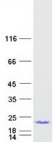 Human ACP1 / Acid Phosphatase Protein (Recombinant Myc-DDK (Flag))