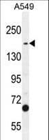TDRD7 Antibody (aa807-835)
