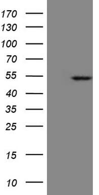 KRT23 / Keratin 23 Antibody (aa1-270, clone OTI3F2)