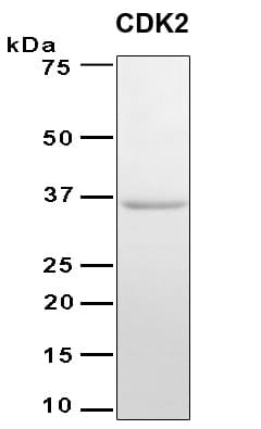 Human CDK2 Protein (Recombinant 6His, N-terminus)