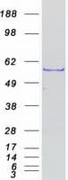 Human TOE1 Protein (Recombinant Myc-DDK (Flag))