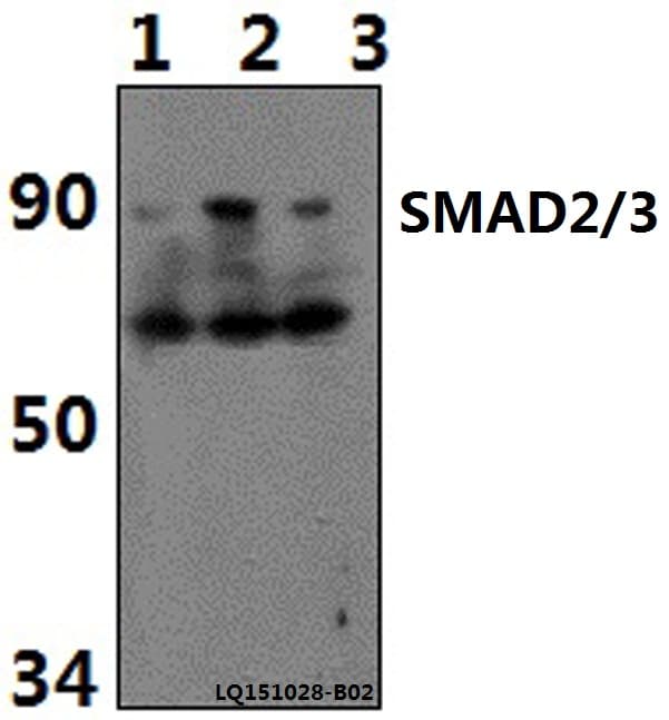 Polyclonal Rabbit anti-Human SMAD2 Antibody (Acetyl-Lys19, WB)
