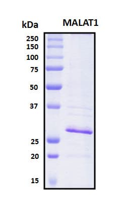 Human MALT1 Protein (Recombinant TRX-6His, N-terminus)