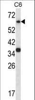 MAPK4 / ERK4 Antibody (aa67-94)
