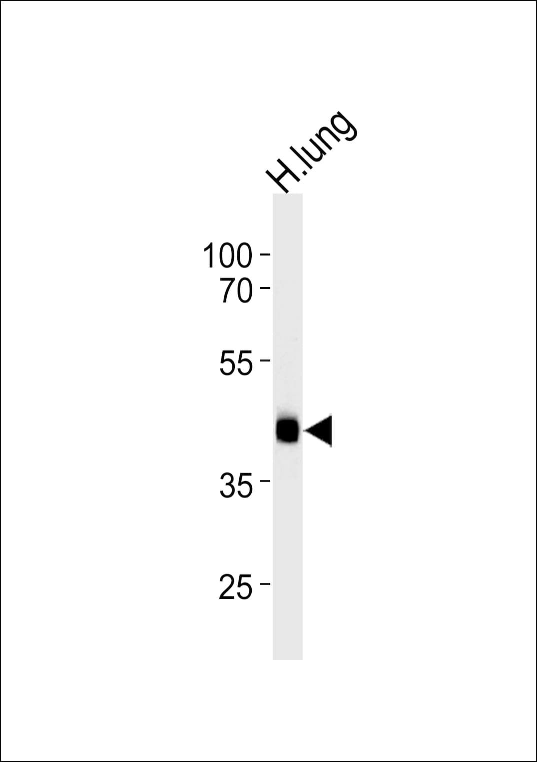 MTRF1 Antibody (aa232-259)