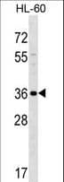 SPOCK3 Antibody (aa36-63)