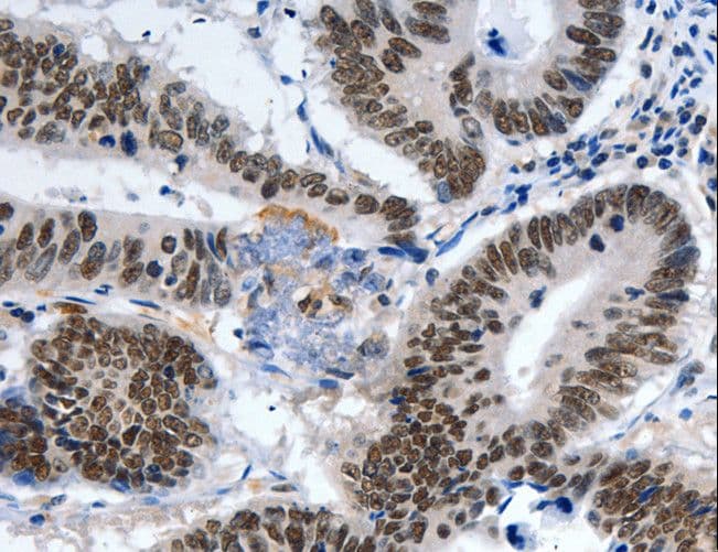 Polyclonal Rabbit anti-Human LRP5 Antibody (IHC)
