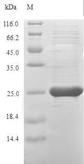 Hamster-Chinese PRDX1 / Peroxiredoxin 1 Protein (Recombinant 6His, N-terminus)