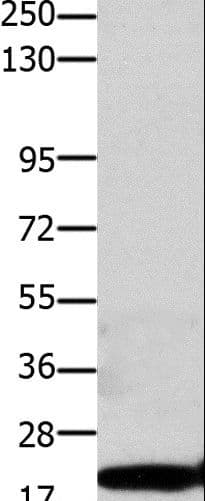 Polyclonal Rabbit anti-Human CLDN1 / Claudin 1 Antibody (IHC, WB)