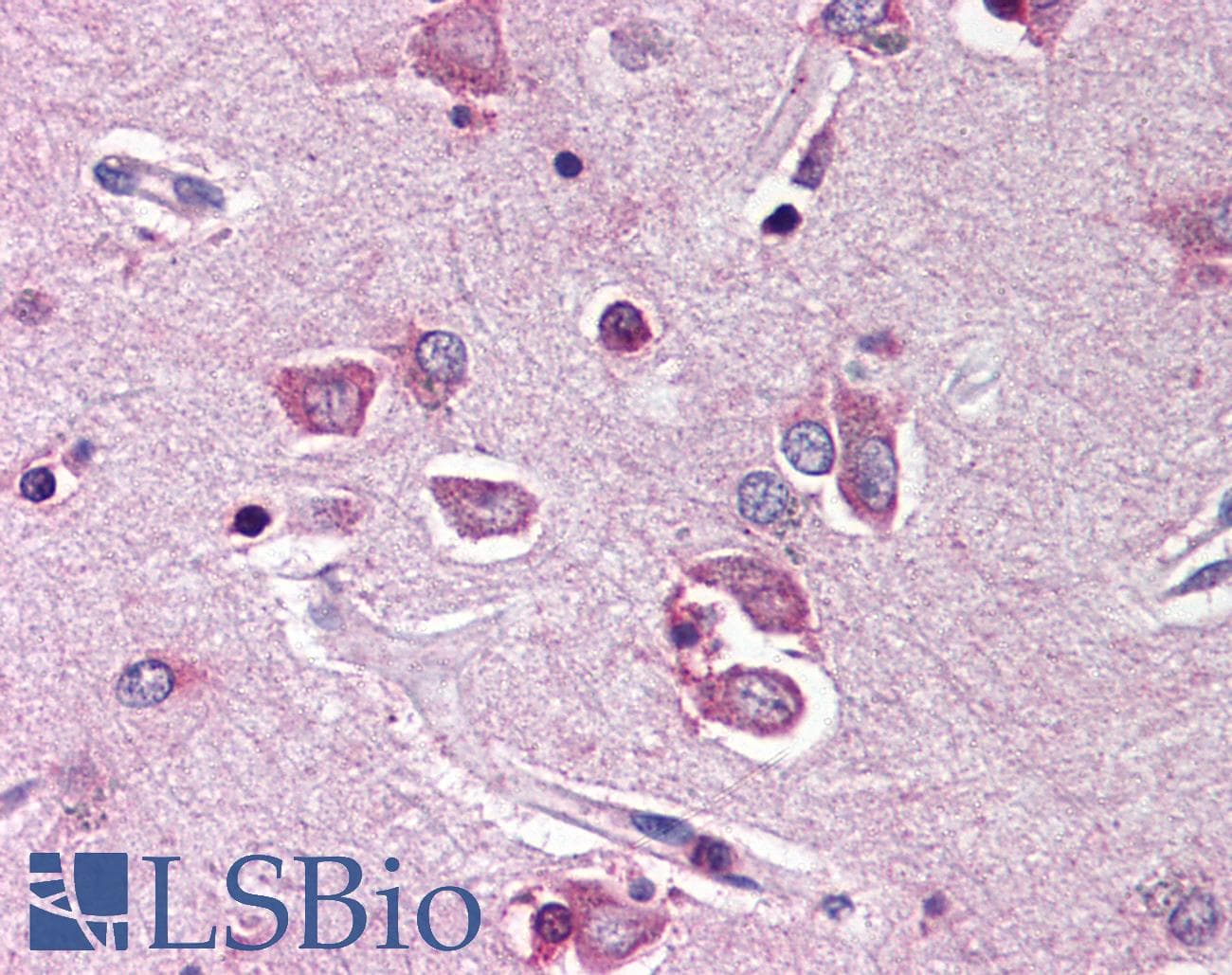 IHC-plus™ PTPN11 / SHP-2 / NS1 Antibody