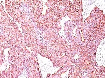 CHGA / Chromogranin A Antibody (clone SPM585)