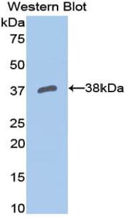 APOH / Apolipoprotein H Antibody (aa21-345)