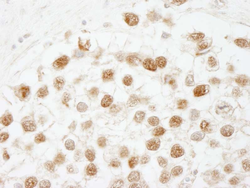 Polyclonal Rabbit anti-Human CHAF1B / CAF1 Antibody (aa509-C-term, IHC)
