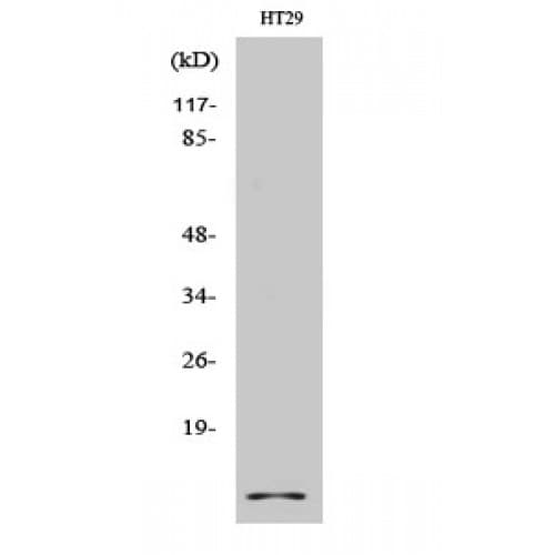 CSTA / Cystatin A Antibody (20-100 aa, Internal)