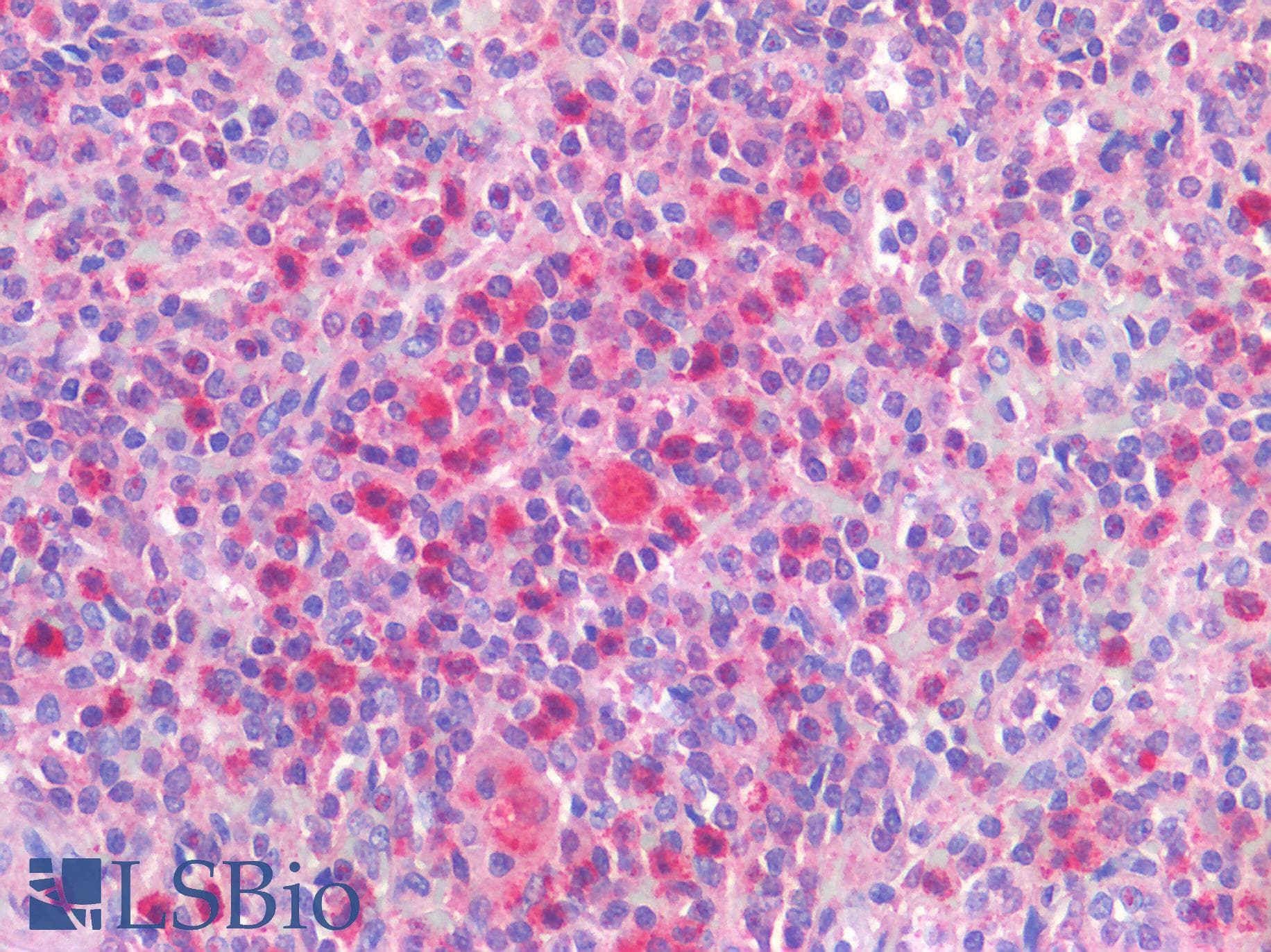 IHC-plus™ Polyclonal Rabbit anti-Human IL-1B / IL-1 Beta Antibody (IHC)