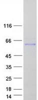 Human Fibulin-3 / EFEMP1 Protein (Recombinant Myc-DDK (Flag))