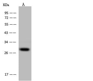 Polyclonal Rabbit anti-Human PCMT1 Antibody (IHC, WB)