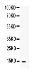 Polyclonal Rabbit anti-Human IL4 Antibody (aa25-153, IHC, WB)