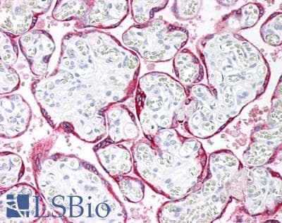 Monoclonal Mouse anti-Human CGA / hCG Alpha Antibody (clone INN-hFSH 100, Alpha 2, IHC)