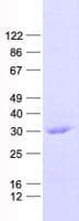 Human IL-33 Protein (Recombinant His, N-Terminal)