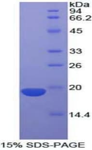 Human CRH / CRF Protein (Recombinant His)