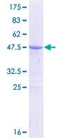 Human CDO1 / Cysteine Dioxygenase Protein (Recombinant GST)