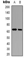 PWWP2B Antibody (Internal)