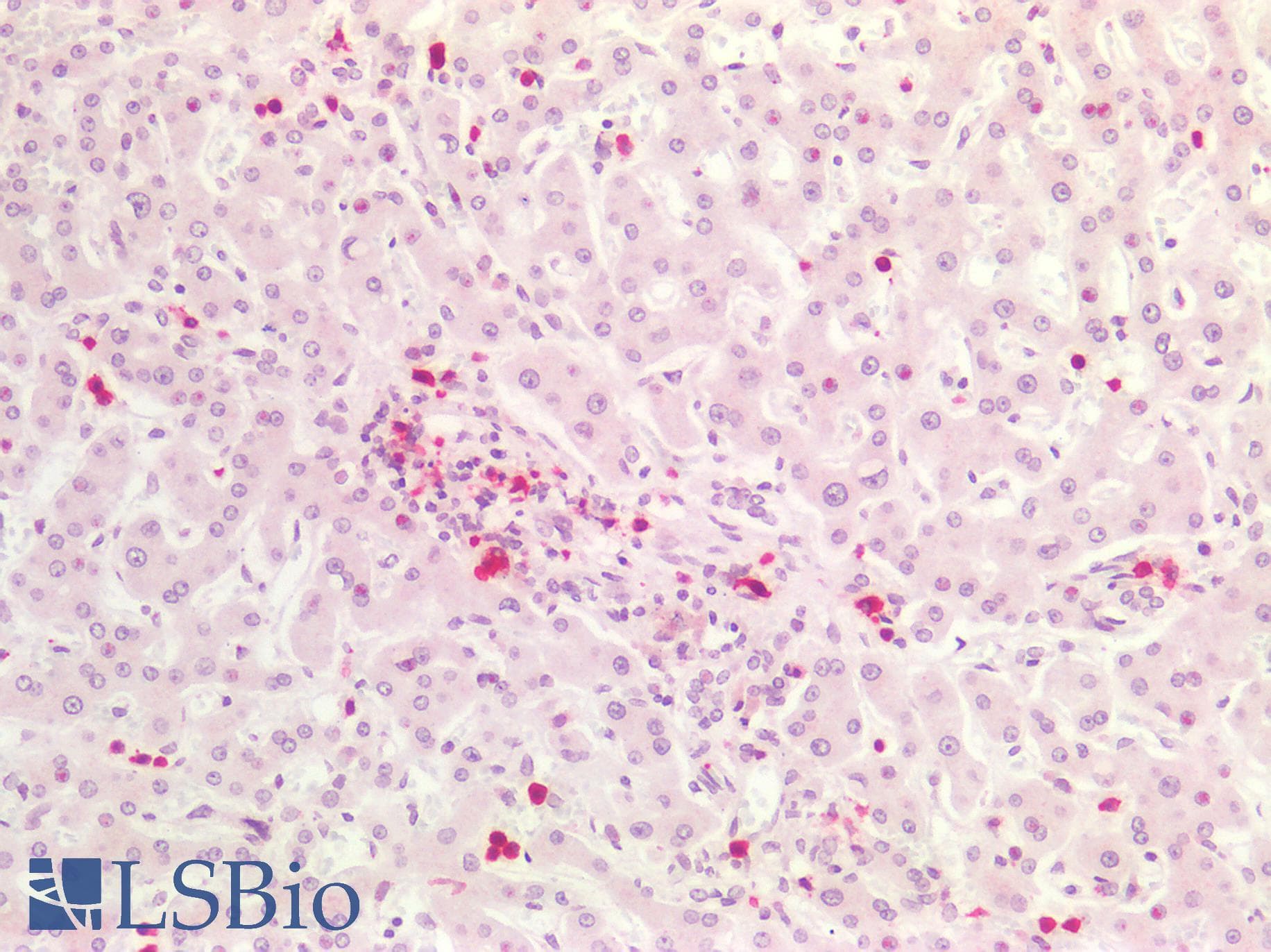 IHC-plus™ Monoclonal Mouse anti-Human S100A8 / MRP8 Antibody (clone CF-145, FITC, IHC, IF, WB)