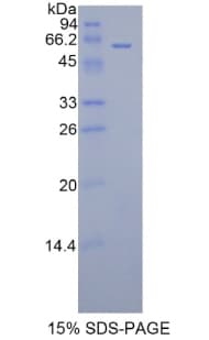 Rat FGL1 / Hepassocin Protein (Recombinant His-GST)