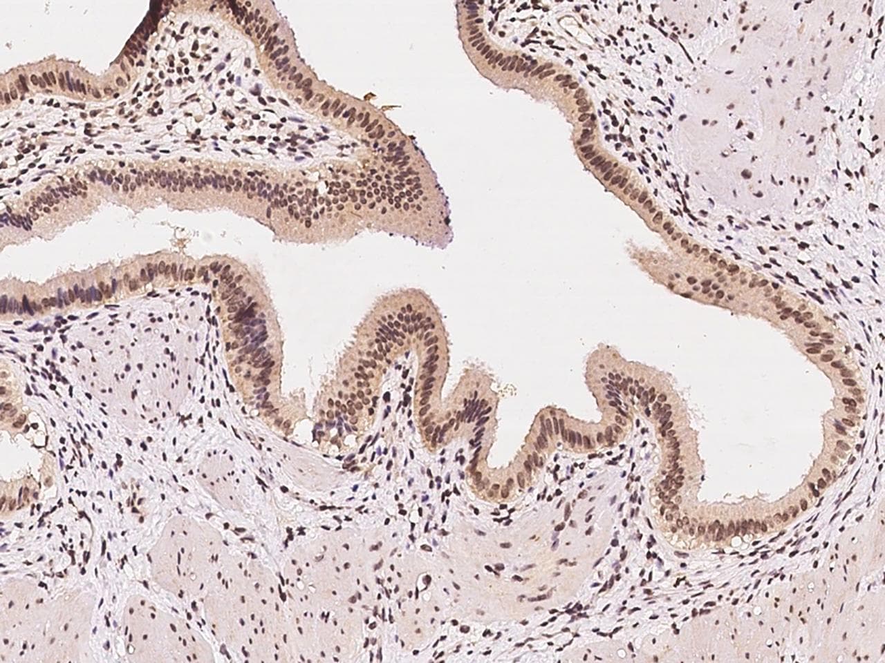 DDX39 Antibody