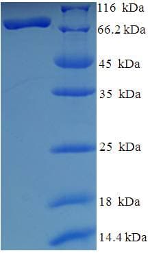 Human HDAC1 Protein (Recombinant His-SUMO)