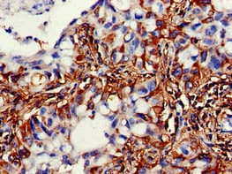 Polyclonal Rabbit anti-Human ACADSB Antibody (IHC, WB)