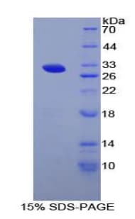 Mouse RNPEP Protein (Recombinant His-T7)