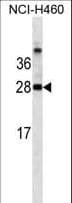 LGALS3 / Galectin 3 Antibody (aa163-191)