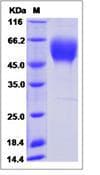 Human KDR / VEGFR2 / FLK1 Protein (Recombinant His,C-terminus)