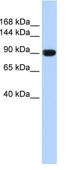 ANO1 / DOG1 / TMEM16A Antibody (aa828-877)