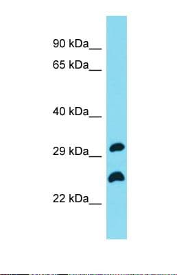 FLJ11286 Antibody (N-Terminus)