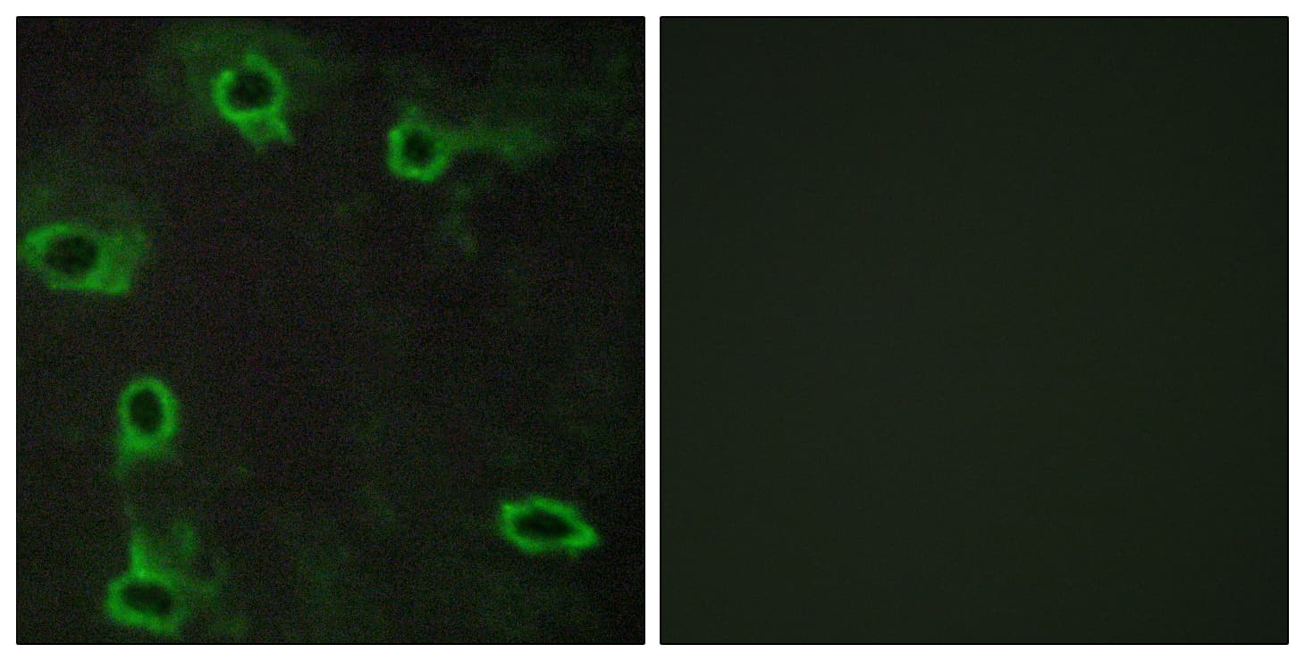 Polyclonal Rabbit anti-Human ADORA2A/Adenosine A2A Receptor Antibody (aa120-169, IHC, IF)