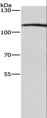 Polyclonal Rabbit anti-Human COPB1 / Beta-COP Antibody (IHC, WB)