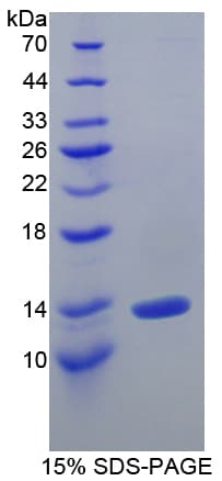 Human IL10RA Protein (Recombinant His)