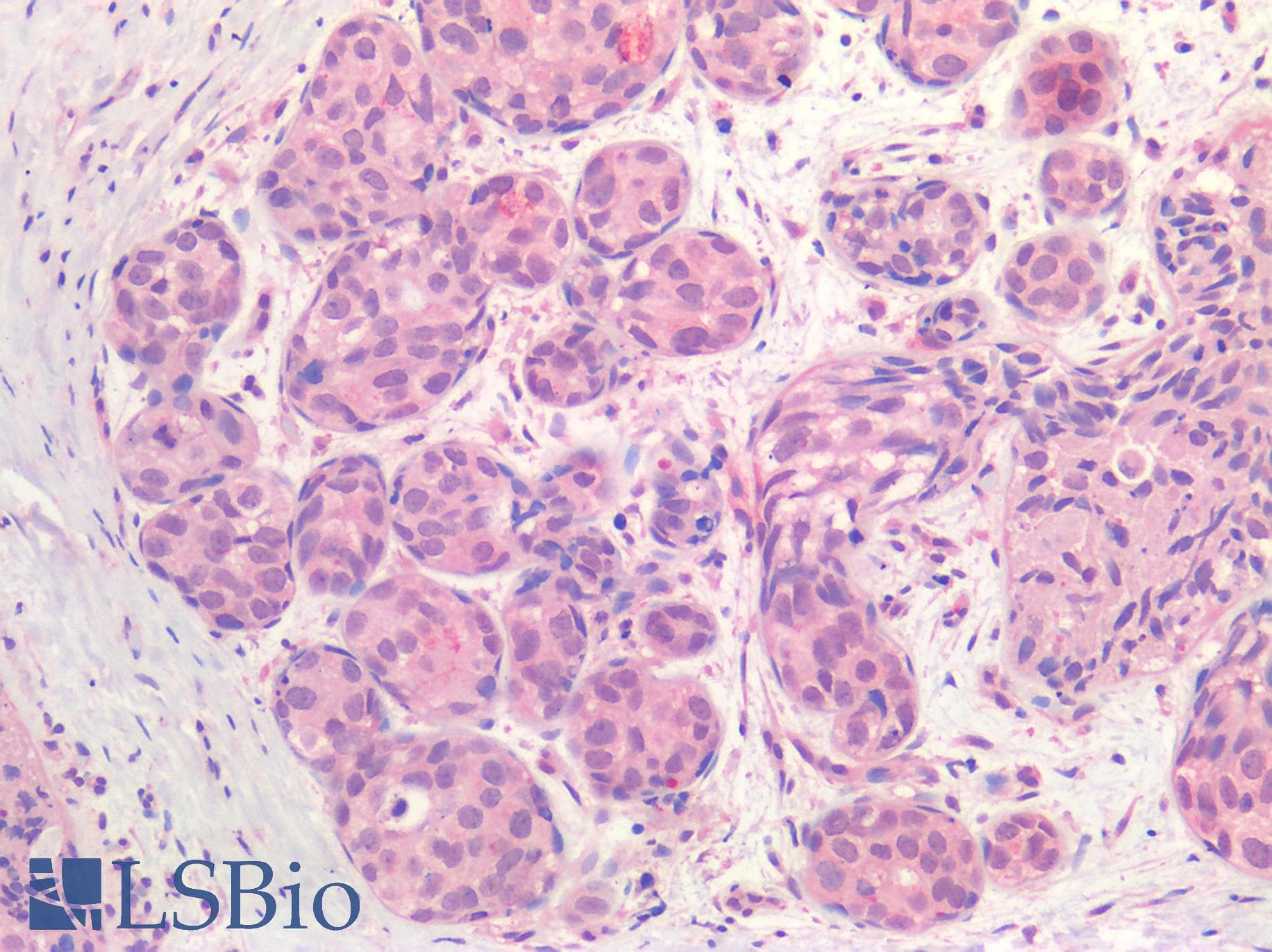 IHC-plus™ Polyclonal Rabbit anti-Human ER Alpha / Estrogen Receptor Antibody (IHC)