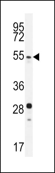 SUV420H2 Antibody (aa60-90)