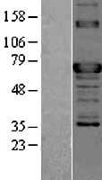 TOR1AIP2 Protein (Over-Expression Lysate Myc-DDK (Flag))