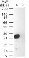 SARS-CoV Matrix Antibody (aa195-210)