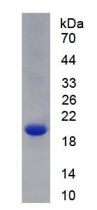 Mouse COL8A2 / Collagen VIII Protein (Recombinant 6His, N-terminus)