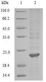 Woodchuck TNF Alpha Protein (Recombinant 10His, N-terminus)