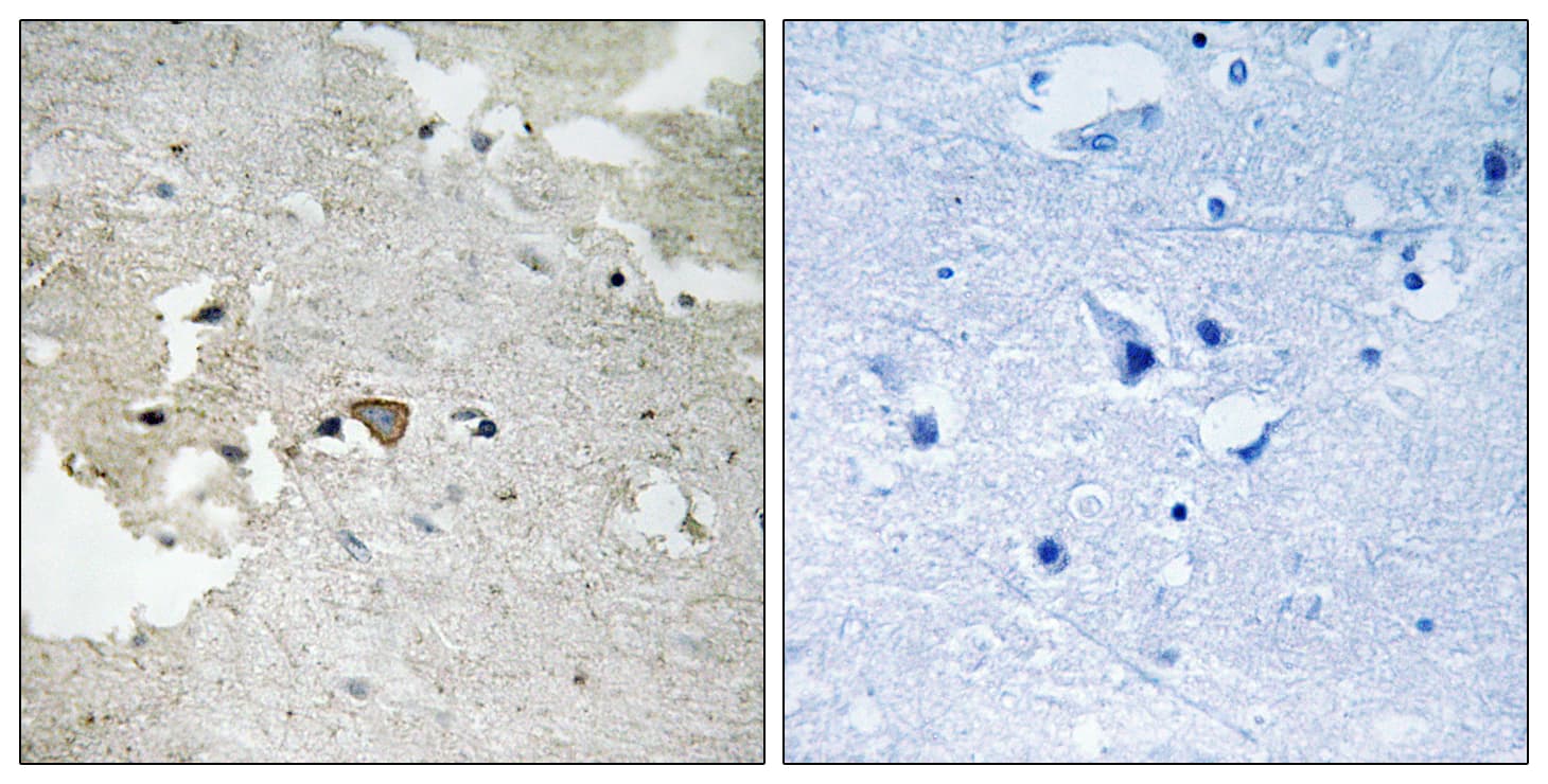 Polyclonal Rabbit anti-Human AXL Antibody (phospho-Tyr691, IHC, WB)