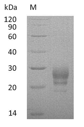Human IL7 Protein (Recombinant 6His, C-terminus)