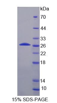 Human INSRR Protein (Recombinant)
